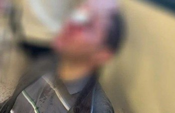 nomiki athinwn traumatias