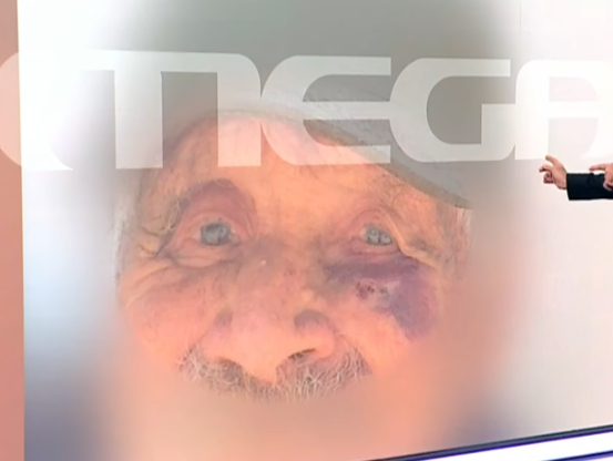 papous mauro mati amfiloxia