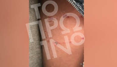 traumatias skylos tsitsipa