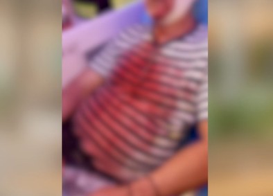 Δημοτικός υπάλληλος μαχαιρώθηκε στην Αθήνα