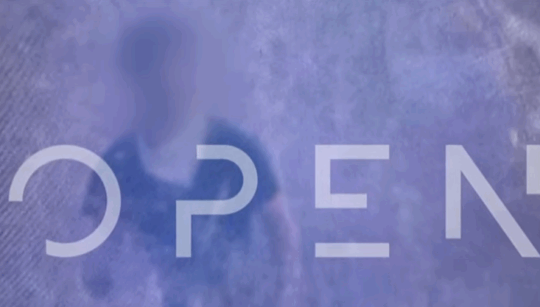 Φωτογραφία ντοκουμέντο από 25χρονο να βάζει φωτιά στην Πάτρα