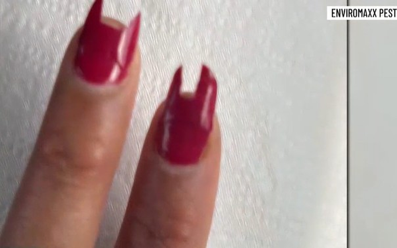 Αρουραίος έφαγε νύχια γυναίκας