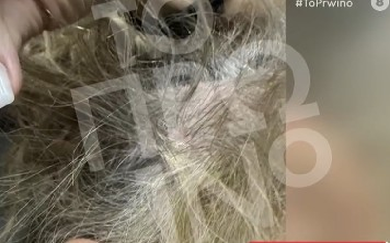 Επίθεση πλαστικού χειρουργού σε γυναίκα οδηγού