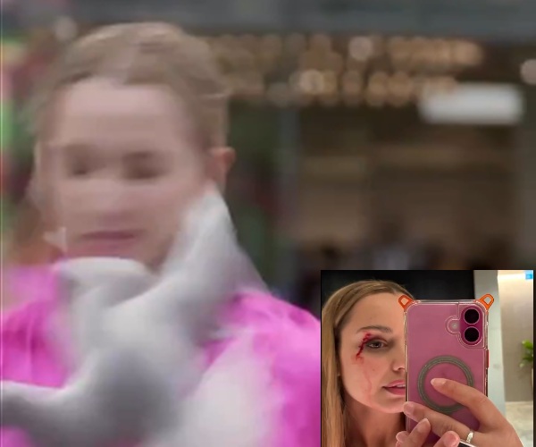 Επίθεση περιστεριού σε δημοσιογράφο