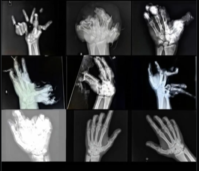 Μήνυμα της ΕΛ.ΑΣ για τη χρήση κροτίδων και πυροτεχνημάτων το Πάσχα